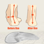 Semelles orthopédiques en gel de silicone