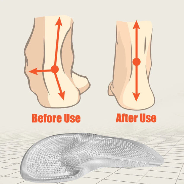 Semelles orthopédiques en gel de silicone